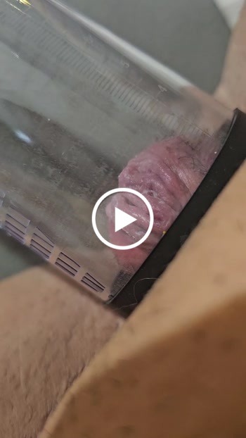 Klitoris aufgepumt!!! - Private Porn - Jetzt ansehen